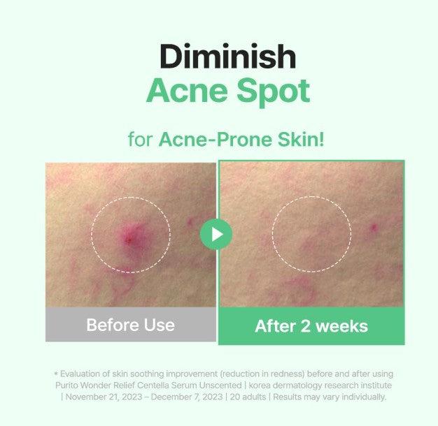 🌿 Purito Wonder Relief Centella Serum - Le Baume Apaisant Quotidien